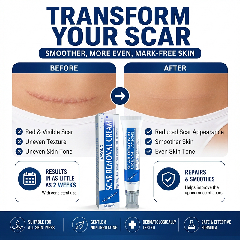 ScarSmooth™ – Great Care Cream for All Types of Skin Marks 🧴