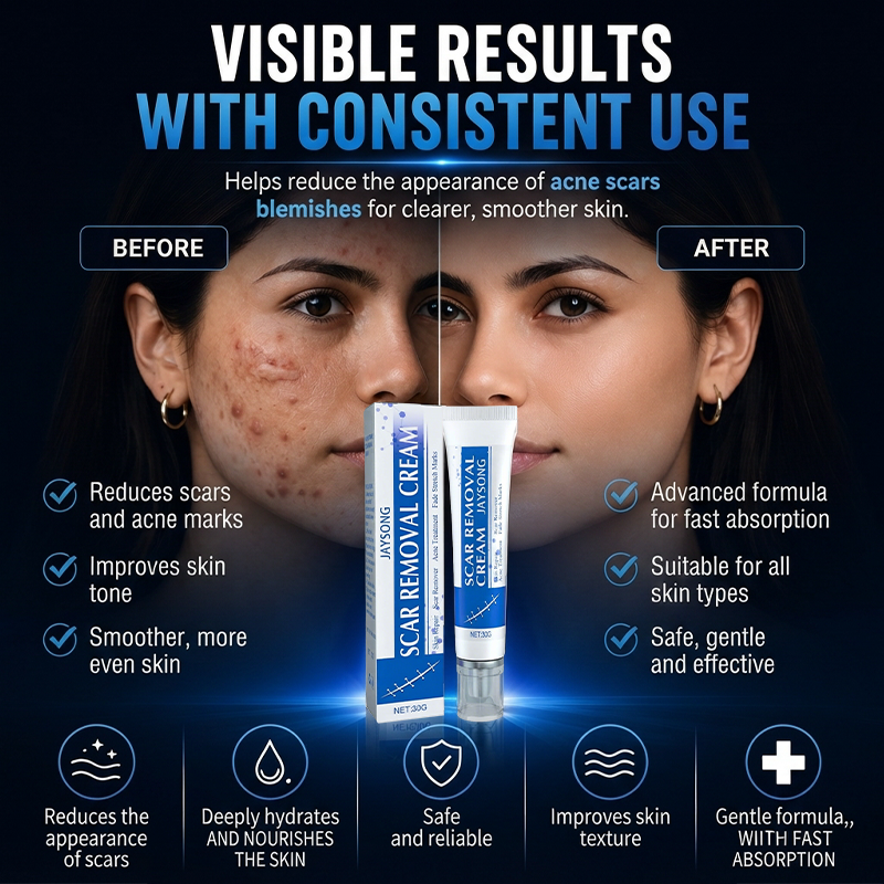 ScarSmooth™ – Great Care Cream for All Types of Skin Marks 🧴