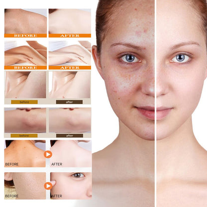 Deep cleansing Turmeric Brightening Facial SkincareCleanser, Comfort Deep Cleansing🧴