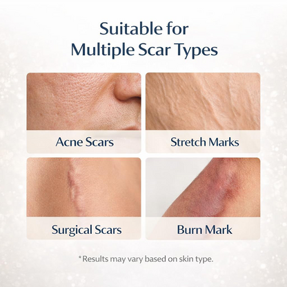 ScarSmooth™ – Great Care Cream for All Types of Skin Marks 🧴