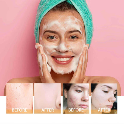 Deep cleansing Turmeric Brightening Facial SkincareCleanser, Comfort Deep Cleansing🧴