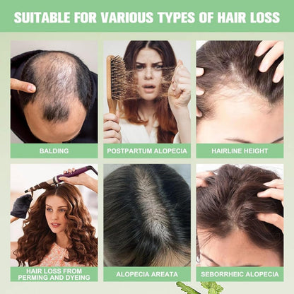 Anti-Hair Fall HairLoss Treatment Shampoo Oil Control Anti Dandruff Haircare