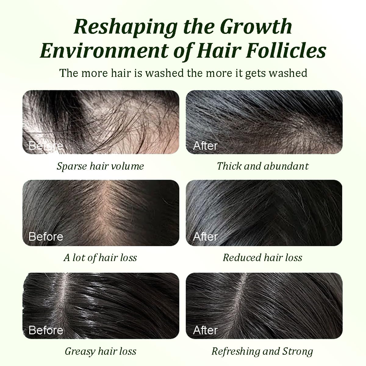 Batana Oil Shampoo for Hair Growth-Repairs all hair types🧴
