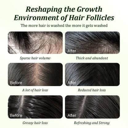 Batana Oil Shampoo for Hair Growth-Repairs all hair types🧴