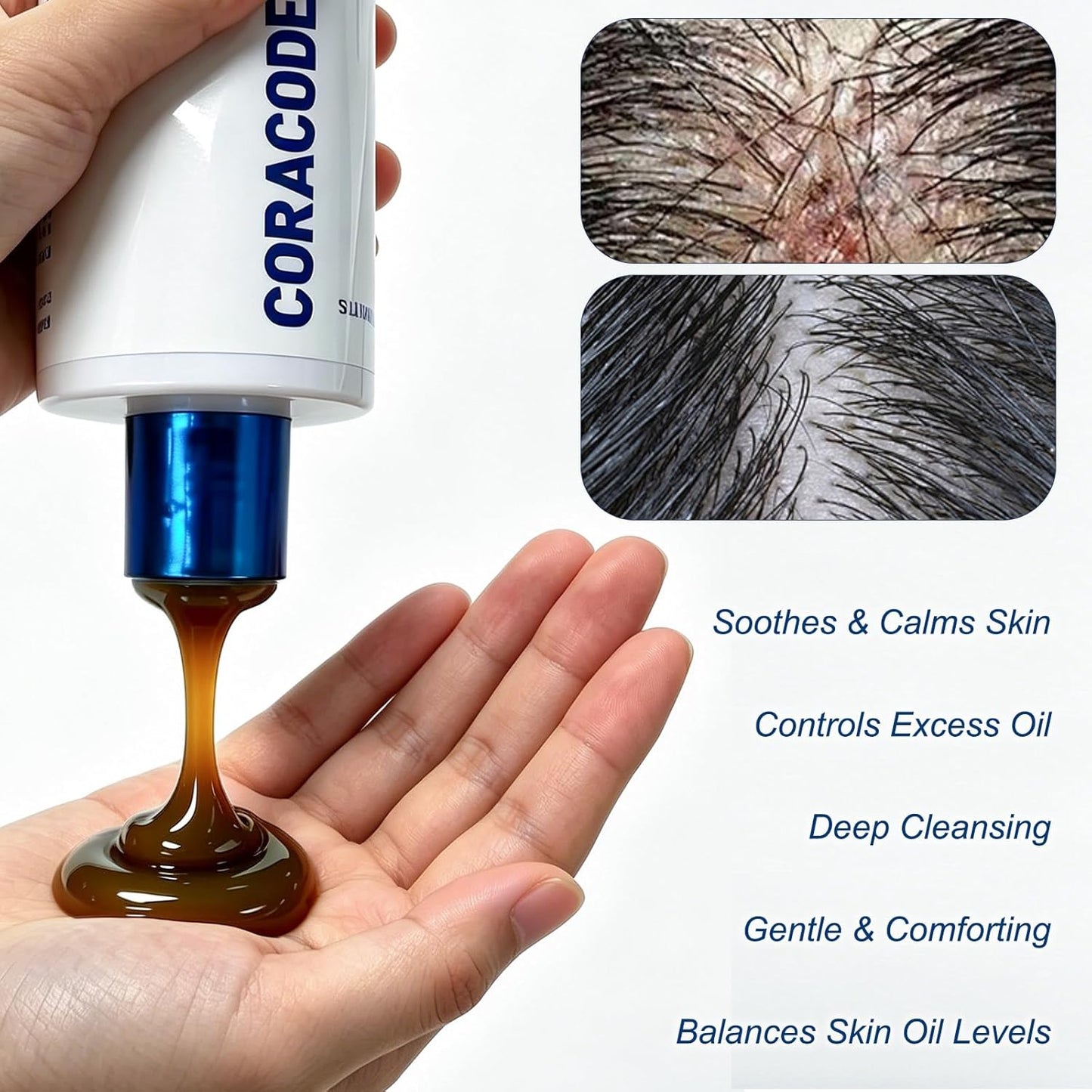 Fol Shampooliculitis for Itchy, Flaky Scalp - Purifying Formula for a Soothed