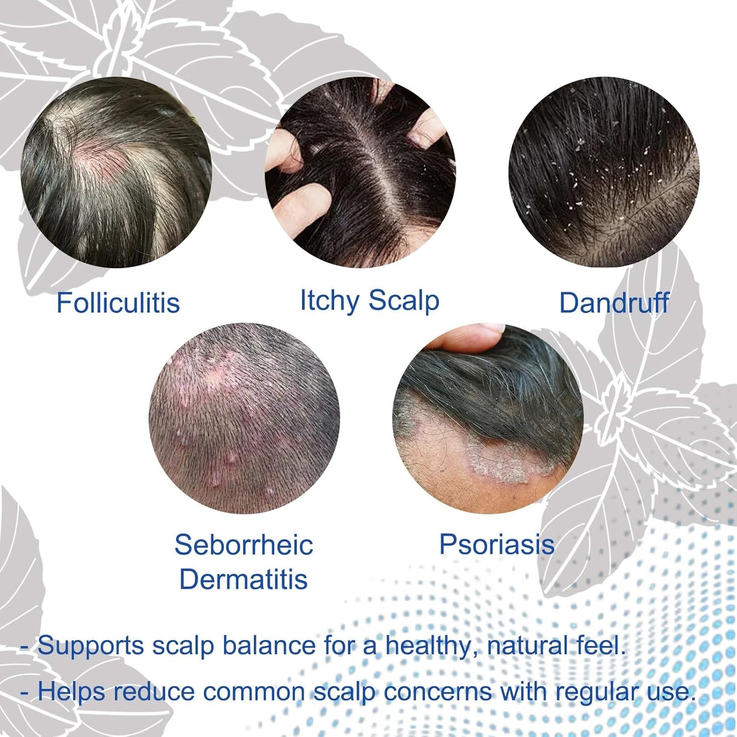 Fol Shampooliculitis for Itchy, Flaky Scalp - Purifying Formula for a Soothed