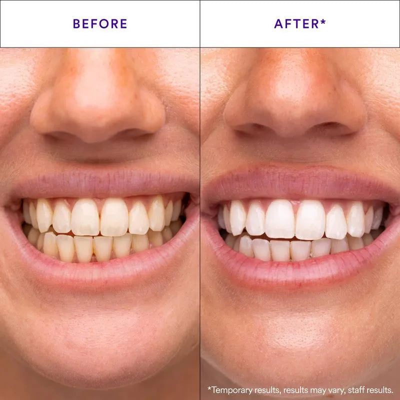 V34 Whitening Strips 14 packs,Combining Whitening and Colour Correction💜