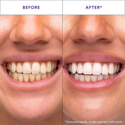 V34 Whitening Strips 14 packs,Combining Whitening and Colour Correction💜