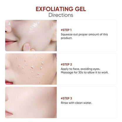 Purifying Exfoliating Gel | Gentle Dead Skin Remover, Pore Minimizing Brightening Exfoliator🔥
